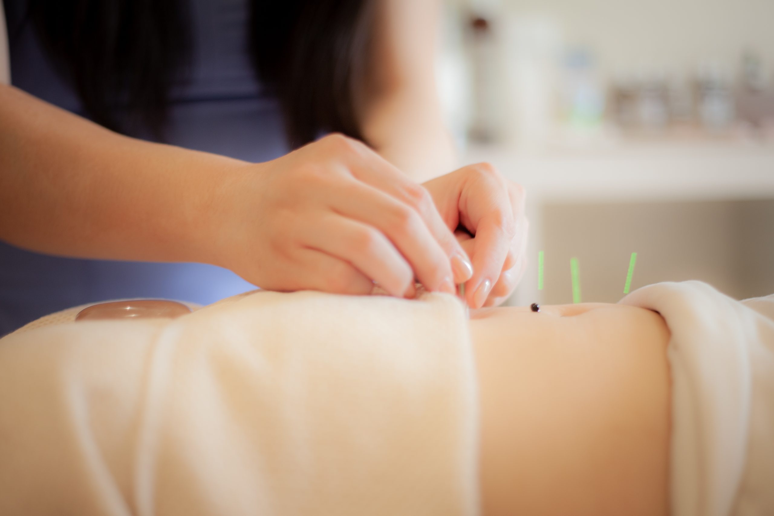 Wellness on Whyte - Acupuncture